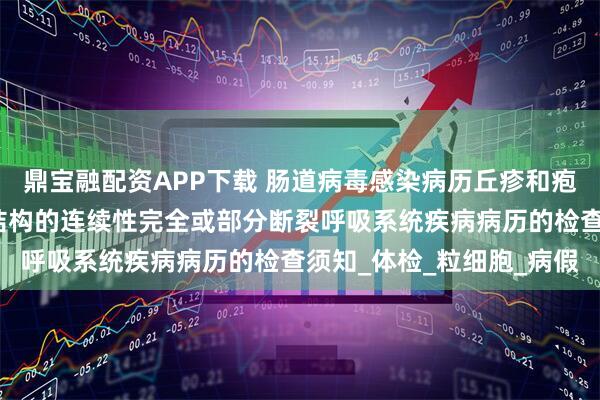 鼎宝融配资APP下载 肠道病毒感染病历丘疹和疱疹消化系统骨折是指骨结构的连续性完全或部分断裂呼吸系统疾病病历的检查须知_体检_粒细胞_病假